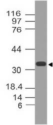 MTAP Antibody - Fig-1: Western blot analysis of MTAP. Anti-MTAP antibody was used at 2 µg/ml on h Brain lysate.