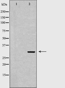 MTAP Antibody - Western blot analysis of HT29 cells using MTAP antibody. The lane on the left is treated with the antigen-specific peptide.