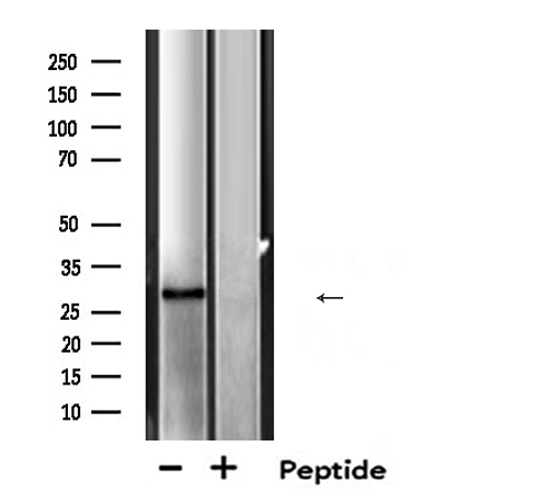 MTAP Antibody - Western blot analysis of extracts of mouse brain lysate using MTAP antibody.