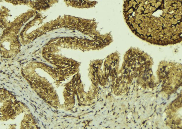 MTAP Antibody - 1:100 staining mouse colon tissue by IHC-P. The sample was formaldehyde fixed and a heat mediated antigen retrieval step in citrate buffer was performed. The sample was then blocked and incubated with the antibody for 1.5 hours at 22°C. An HRP conjugated goat anti-rabbit antibody was used as the secondary.