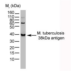 MTB 38kD Antigen Antibody - Recombinant Mycobacterium tuberculosis 38kDa antigen (0100-0158) detected with Mouse anti-Mycobacterium tuberculosis 38kDa antigen (MOUSE ANTI MYCOBACTERIUM TUBERCULOSIS 38kDa ANTIGEN).