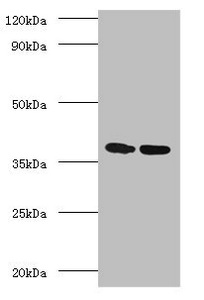 MTB Ag85A Antibody - Western blot All lanes: Antigen 85-A antibody at 2µg/ml Lane 1: Recombinant Mycobacterium tuberculosis Antigen 85-A protein 1µg Lane 2: Recombinant Mycobacterium tuberculosis Antigen 85-A protein 10µg Secondary Goat polyclonal to rabbit IgG at 1/10000 dilution Predicted band size: 36 kDa Observed band size: 36 kDa