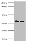 MTB Ag85A Antibody - Western blot All lanes: Antigen 85-A antibody at 2µg/ml Lane 1: Recombinant Mycobacterium tuberculosis Antigen 85-A protein 1µg Lane 2: Recombinant Mycobacterium tuberculosis Antigen 85-A protein 10µg Secondary Goat polyclonal to rabbit IgG at 1/10000 dilution Predicted band size: 36 kDa Observed band size: 36 kDa
