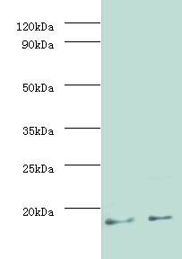 MTB MPT63 Antibody - Western blot of Immunogenic protein MPT63 antibody at 2 ug/ml.  This image was taken for the unconjugated form of this product. Other forms have not been tested.