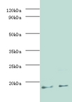 MTB MPT63 Antibody - Western blot of Immunogenic protein MPT63 antibody at 2 ug/ml.  This image was taken for the unconjugated form of this product. Other forms have not been tested.