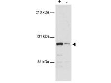 MTBP / Mdm2-Binding Protein Antibody - Western blot using anti-MTBP antibody shows detection of a band ~110 kDa corresponding to human MTBP (arrowhead). Lanes represent human 293 cell lysates with (+) and without (-) transfection with a full-length human expression MTBP construct. The transfected cell extract was diluted 30 fold in extract lacking transfected MTBP. Proteins were separated by SDS-PAGE and transferred onto PDVF membrane. After blocking, the membrane was probed with the primary antibody diluted to 1:500 for 2h at room temperature followed by detection using a Lumi-LightPlus Western Blotting Kit (Roche).