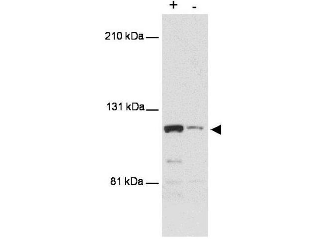 MTBP / Mdm2-Binding Protein Antibody - Western blot using anti-MTBP antibody shows detection of a band ~110 kDa corresponding to human MTBP (arrowhead). Lanes represent human 293 cell lysates with (+) and without (-) transfection with a full-length human expression MTBP construct. The transfected cell extract was diluted 30 fold in extract lacking transfected MTBP. Proteins were separated by SDS-PAGE and transferred onto PDVF membrane. After blocking, the membrane was probed with the primary antibody diluted to 1:500 for 2h at room temperature followed by detection using a Lumi-LightPlus Western Blotting Kit (Roche).