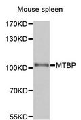 MTBP / Mdm2-Binding Protein Antibody - Western blot analysis of extracts of mouse spleen, using MTBP antibody at 1:1000 dilution. The secondary antibody used was an HRP Goat Anti-Rabbit IgG (H+L) at 1:10000 dilution. Lysates were loaded 25ug per lane and 3% nonfat dry milk in TBST was used for blocking. An ECL Kit was used for detection and the exposure time was 1s.