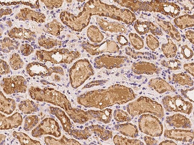 MTBP / Mdm2-Binding Protein Antibody - Immunochemical staining of human MTBP in human kidney with rabbit polyclonal antibody at 1:200 dilution, formalin-fixed paraffin embedded sections.