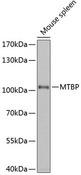 MTBP / Mdm2-Binding Protein Antibody - Western blot analysis of extracts of mouse spleen using MTBP Polyclonal Antibody at dilution of 1:1000.