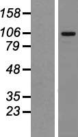 MTBP / Mdm2-Binding Protein Protein - Western validation with an anti-DDK antibody * L: Control HEK293 lysate R: Over-expression lysate