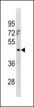 MTCH1 Antibody - MTCH1 Antibody western blot of 293 cell line lysates (35 ug/lane). The MTCH1 antibody detected the MTCH1 protein (arrow).