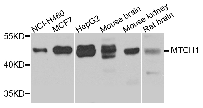 MTCH1 Antibody - Western blot analysis of extracts of various cell lines.