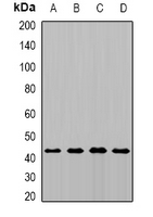 MTCH1 Antibody - Western blot analysis of MTCH1 expression in MCF7 (A); HepG2 (B); mouse kidney (C); rat brain (D) whole cell lysates.