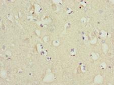 MTCH1 Antibody - Immunohistochemistry of paraffin-embedded human brain tissue at dilution 1:100