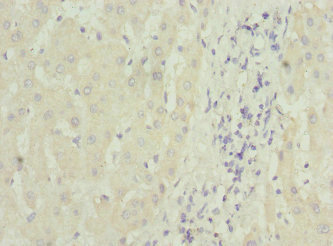 MTCH1 Antibody - Immunohistochemistry of paraffin-embedded human liver tissue at dilution 1:100