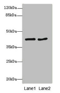 MTCH1 Antibody - Western blot All Lanes: MTCH1antibody at 2.32ug/ml Lane 1 : MCF7 whole cell lysate Lane 2 : HepG-2 whole cell lysate Secondary Goat polyclonal to Rabbit IgG at 1/10000 dilution Predicted band size: 42,40,20 kDa Observed band size: 42 kDa