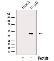 MTCH1 Antibody - Western blot analysis of extracts of HepG2 cells using MTCH1 antibody. The lane on the left was treated with blocking peptide.