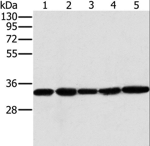 MTCH2 Antibody - Western blot analysis of Human testis tissue and K562 cell, PC3 cell and human liver cancer tissue, HeLa cell, using MTCH2 Polyclonal Antibody at dilution of 1:400.