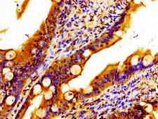 MTCH2 Antibody - Immunohistochemistry image of paraffin-embedded human small intestine tissue at a dilution of 1:100