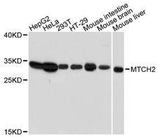 MTCH2 Antibody - Western blot analysis of extracts of various cell lines, using MTCH2 antibody at 1:3000 dilution. The secondary antibody used was an HRP Goat Anti-Rabbit IgG (H+L) at 1:10000 dilution. Lysates were loaded 25ug per lane and 3% nonfat dry milk in TBST was used for blocking. An ECL Kit was used for detection and the exposure time was 30s.