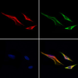 MTCH2 Antibody - Staining HeLa cells by IF/ICC. The samples were fixed with PFA and permeabilized in 0.1% Triton X-100, then blocked in 10% serum for 45 min at 25°C. Samples were then incubated with primary Ab(1:200) and mouse anti-beta tubulin Ab(1:200) for 1 hour at 37°C. An AlexaFluor594 conjugated goat anti-rabbit IgG(H+L) Ab(1:200 Red) and an AlexaFluor488 conjugated goat anti-mouse IgG(H+L) Ab(1:600 Green) were used as the secondary antibod
