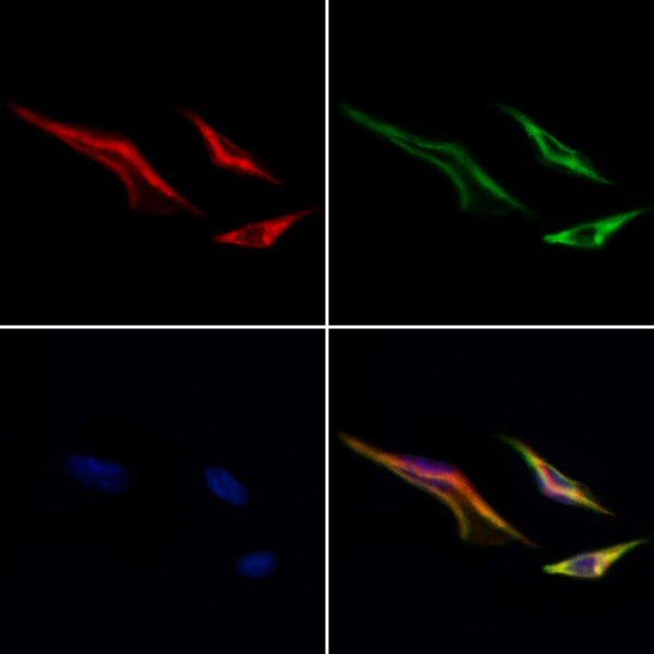 MTCH2 Antibody - Staining HeLa cells by IF/ICC. The samples were fixed with PFA and permeabilized in 0.1% Triton X-100, then blocked in 10% serum for 45 min at 25°C. Samples were then incubated with primary Ab(1:200) and mouse anti-beta tubulin Ab(1:200) for 1 hour at 37°C. An AlexaFluor594 conjugated goat anti-rabbit IgG(H+L) Ab(1:200 Red) and an AlexaFluor488 conjugated goat anti-mouse IgG(H+L) Ab(1:600 Green) were used as the secondary antibod