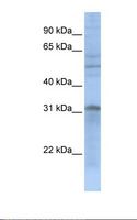 MTCH2 Antibody - 721_B cell lysate. Antibody concentration: 1.0 ug/ml. Gel concentration: 12%.  This image was taken for the unconjugated form of this product. Other forms have not been tested.