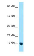 MTCP1NB Antibody - MTCP1NB antibody Western Blot of 293T.  This image was taken for the unconjugated form of this product. Other forms have not been tested.