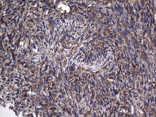 MTDH / Metadherin Antibody - Immunohistochemical staining of paraffin-embedded Human Ovary tissue within the normal limits using anti-MTDH mouse monoclonal antibody. (Heat-induced epitope retrieval by 1 mM EDTA in 10mM Tris, pH8.5, 120C for 3min,