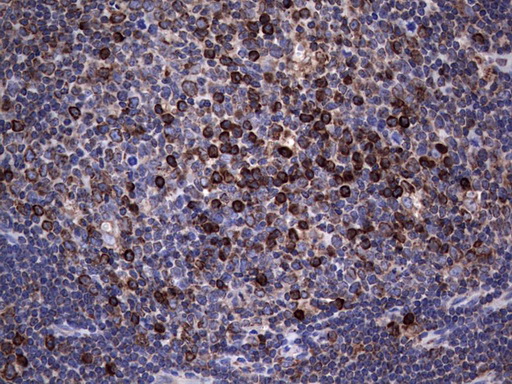 MTDH / Metadherin Antibody - Immunohistochemical staining of paraffin-embedded Human lymph node tissue within the normal limits using anti-MTDH mouse monoclonal antibody. (Heat-induced epitope retrieval by 1 mM EDTA in 10mM Tris, pH8.5, 120C for 3min,