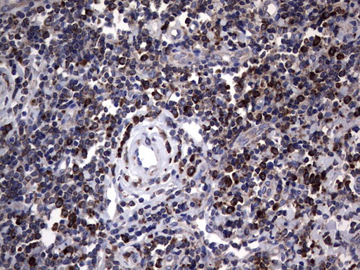 MTDH / Metadherin Antibody - Immunohistochemical staining of paraffin-embedded Human tonsil within the normal limits using anti-MTDH mouse monoclonal antibody. (Heat-induced epitope retrieval by 1 mM EDTA in 10mM Tris, pH8.5, 120C for 3min,