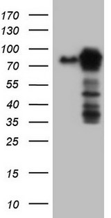 MTDH / Metadherin Antibody - HEK293T cells were transfected with the pCMV6-ENTRY control. (Left lane) or pCMV6-ENTRY MTDH. (Right lane) cDNA for 48 hrs and lysed. Equivalent amounts of cell lysates. (5 ug per lane) were separated by SDS-PAGE and immunoblotted with anti-MTDH.
