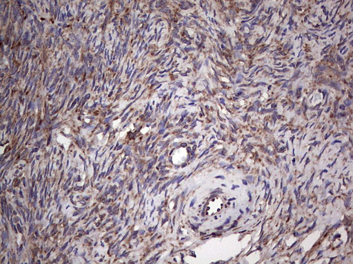 MTDH / Metadherin Antibody - Immunohistochemical staining of paraffin-embedded Human Ovary tissue within the normal limits using anti-MTDH mouse monoclonal antibody. (Heat-induced epitope retrieval by 1 mM EDTA in 10mM Tris, pH8.5, 120C for 3min,