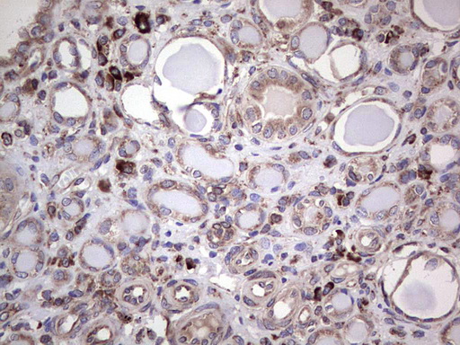MTDH / Metadherin Antibody - Immunohistochemical staining of paraffin-embedded Human Kidney tissue within the normal limits using anti-MTDH mouse monoclonal antibody. (Heat-induced epitope retrieval by 1 mM EDTA in 10mM Tris, pH8.5, 120C for 3min,