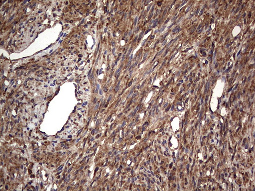 MTDH / Metadherin Antibody - IHC of paraffin-embedded Human endometrium tissue using anti-MTDH mouse monoclonal antibody. (Heat-induced epitope retrieval by 1 mM EDTA in 10mM Tris, pH8.5, 120°C for 3min).
