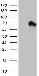 MTDH / Metadherin Antibody - HEK293T cells were transfected with the pCMV6-ENTRY control (Left lane) or pCMV6-ENTRY MTDH (Right lane) cDNA for 48 hrs and lysed. Equivalent amounts of cell lysates (5 ug per lane) were separated by SDS-PAGE and immunoblotted with anti-MTDH.
