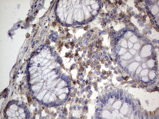MTDH / Metadherin Antibody - IHC of paraffin-embedded Human colon tissue using anti-MTDH mouse monoclonal antibody. (Heat-induced epitope retrieval by 1 mM EDTA in 10mM Tris, pH8.5, 120°C for 3min).