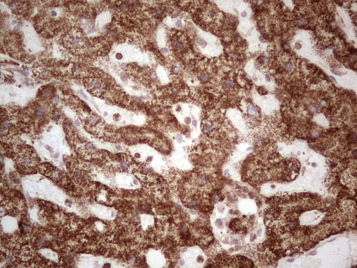 MTDH / Metadherin Antibody - IHC of paraffin-embedded Human liver tissue using anti-MTDH mouse monoclonal antibody. (Heat-induced epitope retrieval by 1 mM EDTA in 10mM Tris, pH8.5, 120°C for 3min).