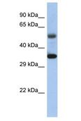 MTERF1 Antibody - MTERF antibody Western Blot of Fetal Kidney. Antibody dilution: 1 ug/ml.  This image was taken for the unconjugated form of this product. Other forms have not been tested.
