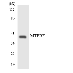 MTERF1 Antibody - Western blot analysis of the lysates from HUVECcells using MTERF antibody.