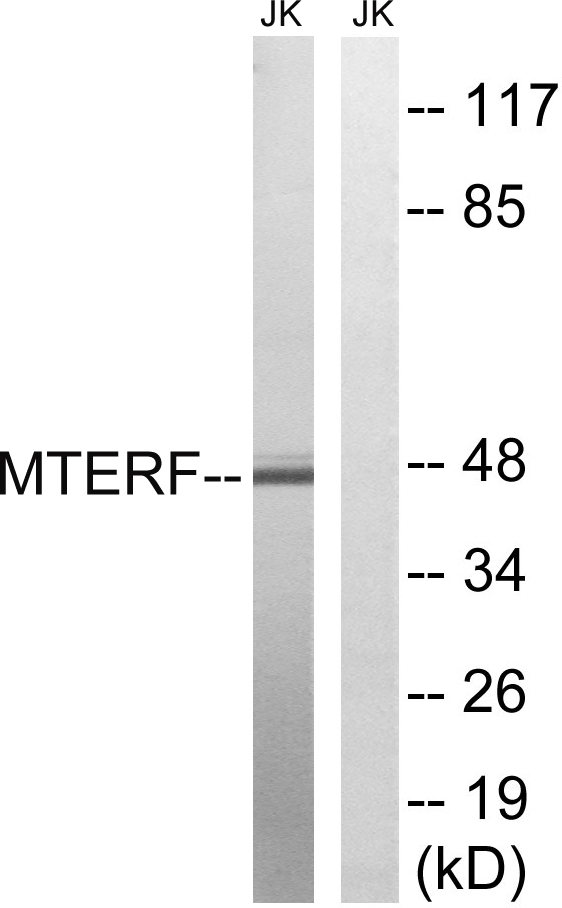 MTERF1 Antibody - Western blot analysis of lysates from Jurkat cells, using MTERF Antibody. The lane on the right is blocked with the synthesized peptide.