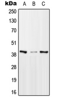 MTERF1 Antibody - Western blot analysis of mTERF expression in HeLa (A); Raw264.7 (B); PC12 (C) whole cell lysates.