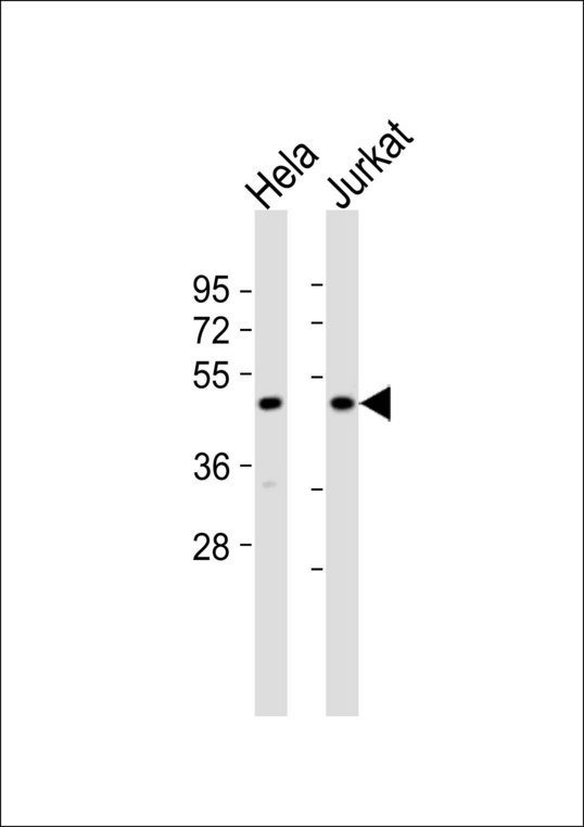 MTERF1 Antibody - All lanes : Anti-mTERF Antibody at 1:1000 dilution Lane 1: HeLa whole cell lysates Lane 2: Jurkat whole cell lysates Lysates/proteins at 20 ug per lane. Secondary Goat Anti-Rabbit IgG, (H+L),Peroxidase conjugated at 1/10000 dilution Predicted band size : 46 kDa Blocking/Dilution buffer: 5% NFDM/TBST.