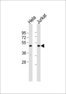 MTERF1 Antibody - All lanes : Anti-mTERF Antibody at 1:1000 dilution Lane 1: HeLa whole cell lysates Lane 2: Jurkat whole cell lysates Lysates/proteins at 20 ug per lane. Secondary Goat Anti-Rabbit IgG, (H+L),Peroxidase conjugated at 1/10000 dilution Predicted band size : 46 kDa Blocking/Dilution buffer: 5% NFDM/TBST.