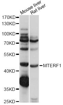 MTERF1 Antibody - Western blot analysis of extracts of various cell lines, using MTERF1 antibody at 1:1000 dilution. The secondary antibody used was an HRP Goat Anti-Rabbit IgG (H+L) at 1:10000 dilution. Lysates were loaded 25ug per lane and 3% nonfat dry milk in TBST was used for blocking. An ECL Kit was used for detection and the exposure time was 1s.