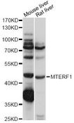 MTERF1 Antibody - Western blot analysis of extracts of various cell lines, using MTERF1 antibody at 1:1000 dilution. The secondary antibody used was an HRP Goat Anti-Rabbit IgG (H+L) at 1:10000 dilution. Lysates were loaded 25ug per lane and 3% nonfat dry milk in TBST was used for blocking. An ECL Kit was used for detection and the exposure time was 1s.