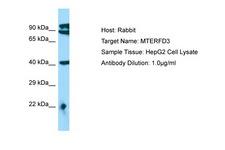 MTERF2 / MTERFD3 Antibody -  This image was taken for the unconjugated form of this product. Other forms have not been tested.