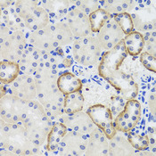 MTERF2 / MTERFD3 Antibody - Immunohistochemistry of paraffin-embedded mouse kidney tissue.