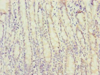 MTERF2 / MTERFD3 Antibody - Immunohistochemistry of paraffin-embedded human small intestine tissue at dilution of 1:100